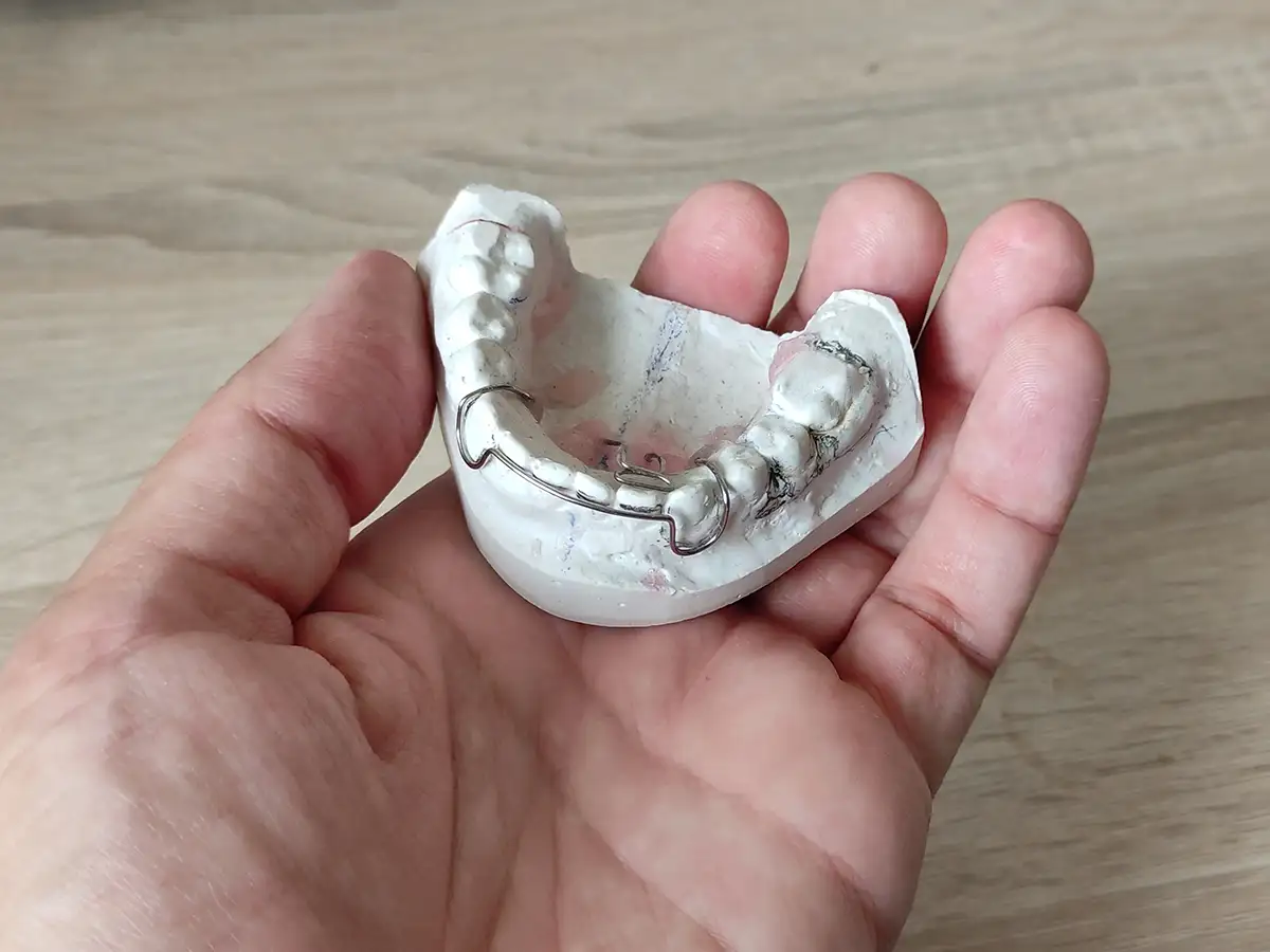 An hand holding a orthodontics cast